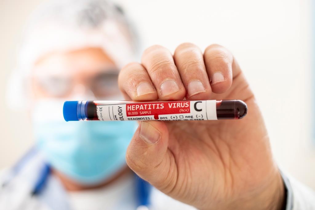 Tes Darah Infeksi Hepatitis C